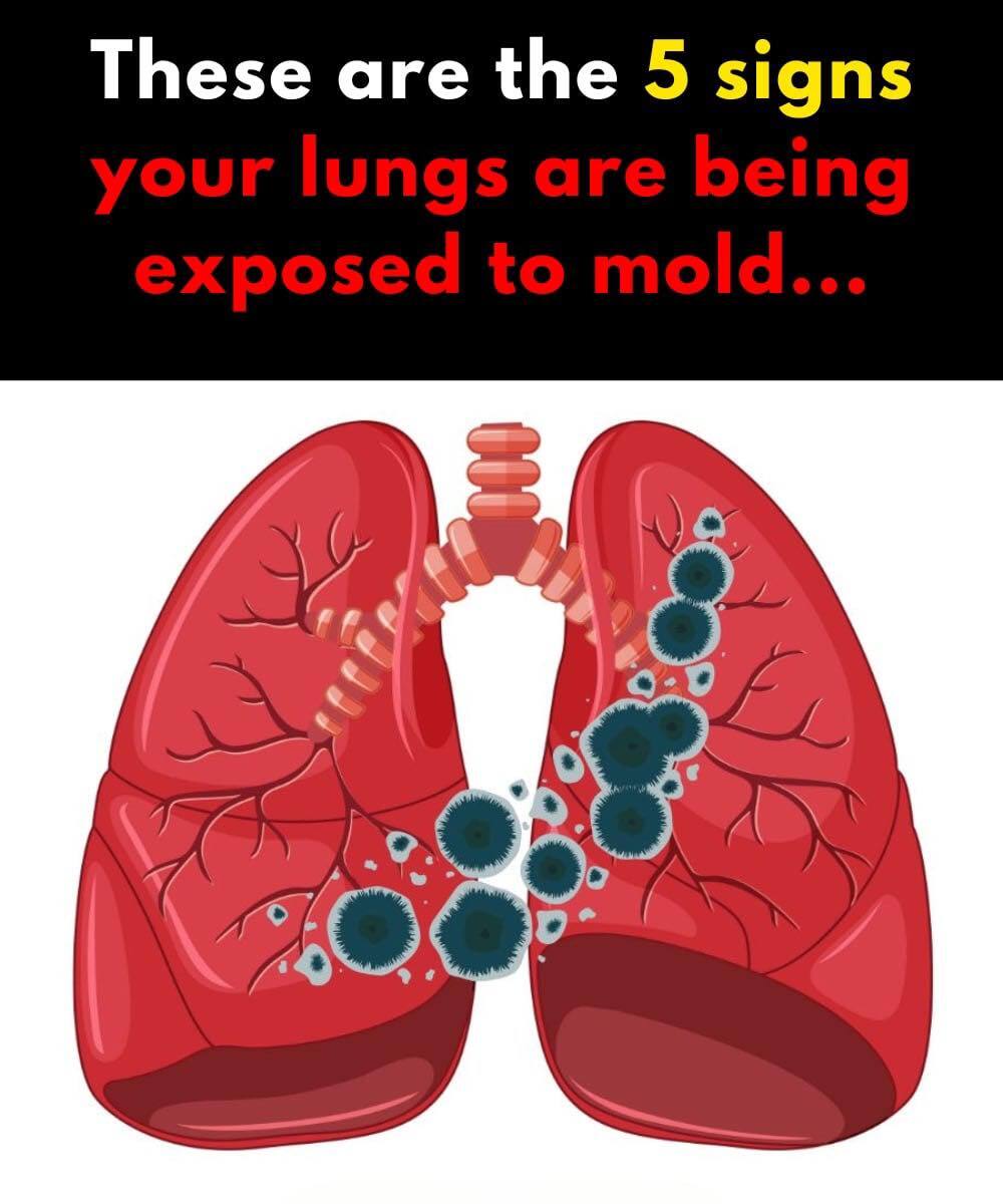 5 Signs Your Lungs are Being Exposed to Mold