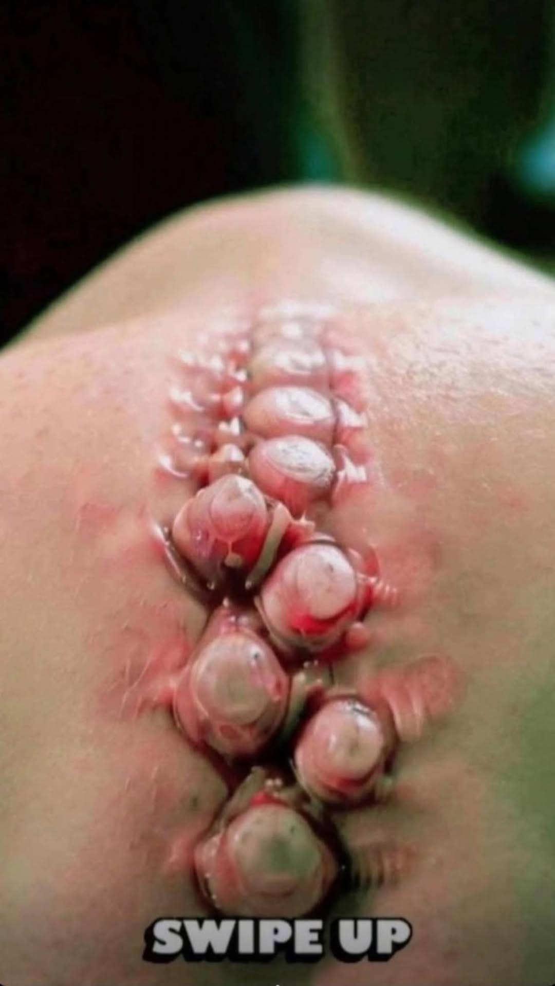 SEVEN THINGS THAT CLOG YOUR PORES AND CAUSE ACNE