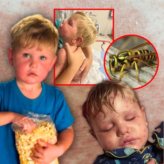Georgia Toddler, 2, Is on Life Support After Being Stung Over 150 Times by Yellowjackets