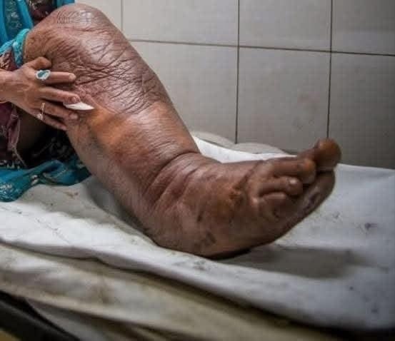 These are the consequences of sleeping with a… See more