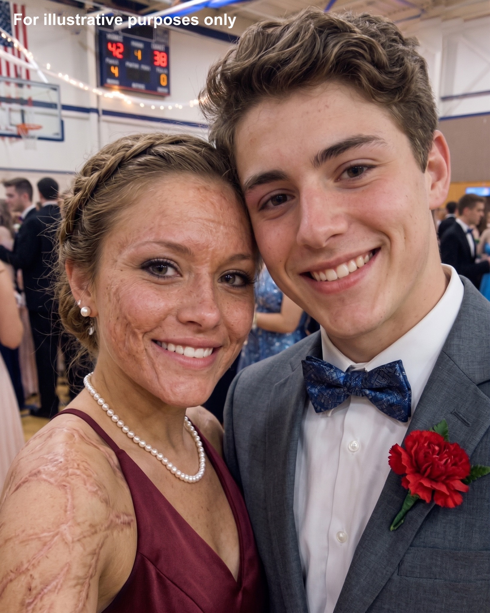 A Boy Asked Me to Dance at Prom Because Everyone Avoided Me for My Scars — The Next Morning, His Parents and Police Showed Up at My Door