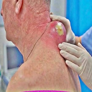 What Is Growing on My Back?