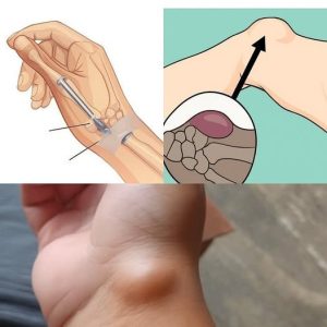Healing Power And Important Safety Tips Of Castor Leaves