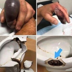 He Sat Down to Use the Bathroom — Then His Life Changed in Seconds